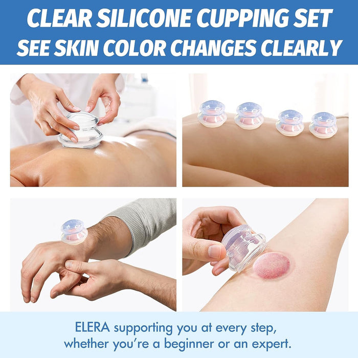 ELERA Silicone Cupping Set,Anti-ageing and Anti-cellulite, Promotes Blood Circulation, Relieves Pain, Ideal for Body Massage(4 Cups 3 Sizes)-6976892099986