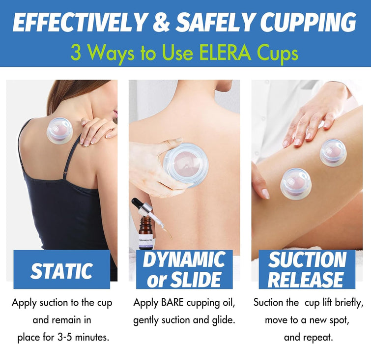 ELERA Silicone Cupping Set,Anti-ageing and Anti-cellulite, Promotes Blood Circulation, Relieves Pain, Ideal for Body Massage(4 Cups 3 Sizes)-6976892099986